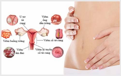 5 bệnh lý phụ khoa thường gặp(CAM)2