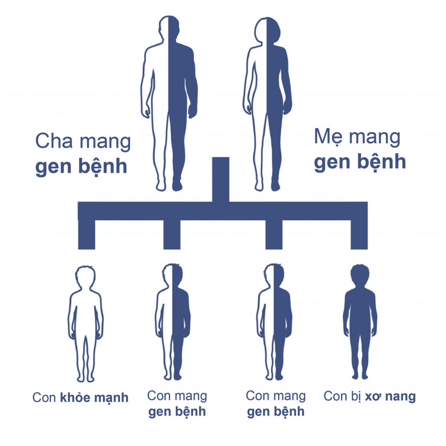 Những Thông Tin Về Bệnh Xơ Nang Phổi(CAM)