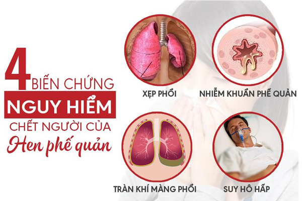 Biến Chứng Nguy Hiểm Của Bệnh Hen Suyễn(CAM)