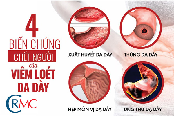 Triệu Chứng Viêm Loét Dạ Dày Tá Tràng