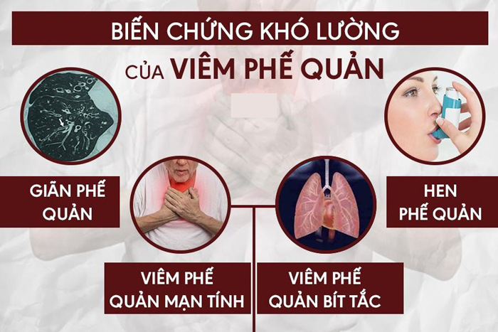 Viêm Phế Quản Cấp Có Nguy Hiểm Không?