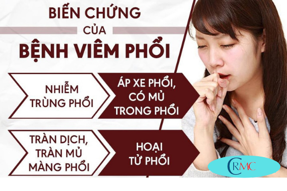 Biến Chứng Nguy Hiểm Của Viêm Phổi(CAM)