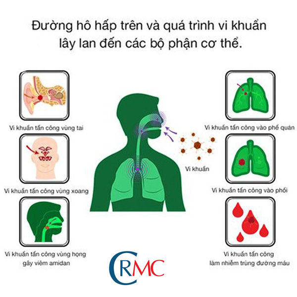 Bệnh Lý Về Đường Hô Hấp Thường Gặp(CAM)