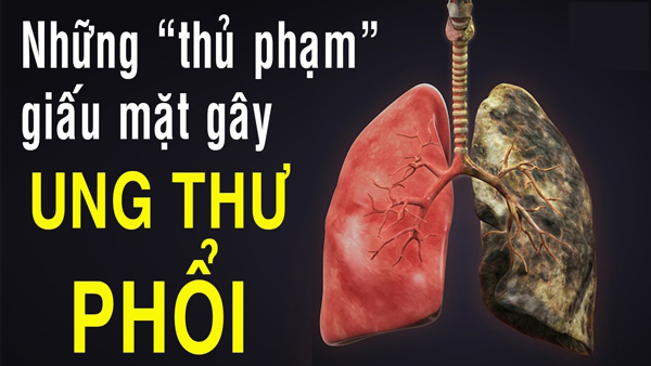 Nguyên Nhân Gây Ung Thư Phổi