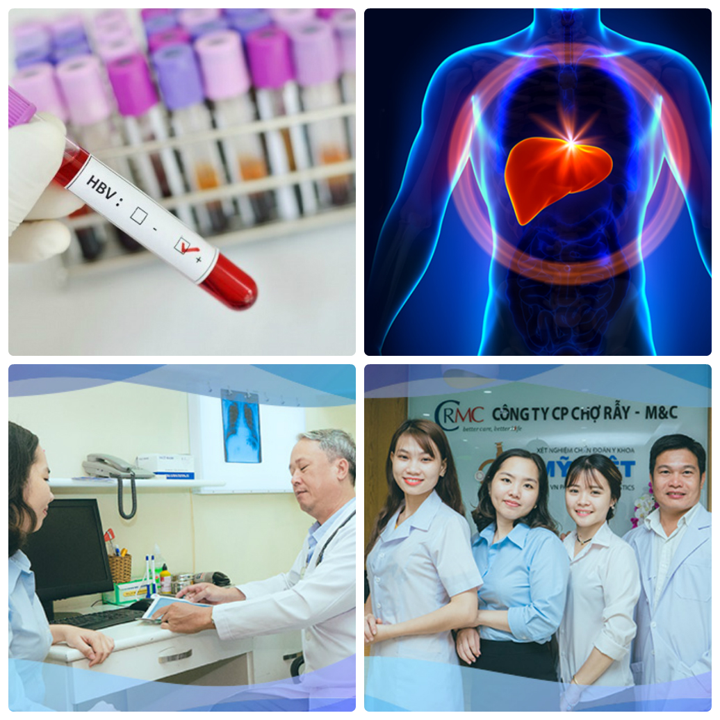 Gói Tầm Soát Viêm Gan
