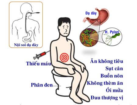 Triệu Chứng Của Bệnh Nội Tiêu Hóa