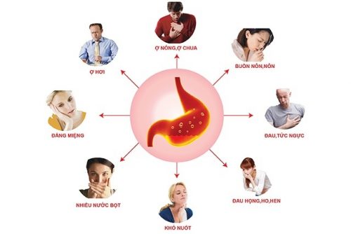 Triệu Chứng Nhận Biết Bệnh Trào Ngược Dạ Dày Thực Quản