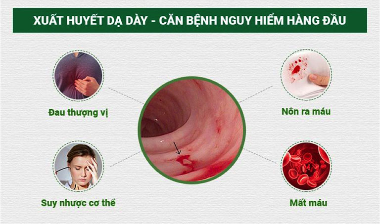 Xuất Huyết Dạ Dày – Nguyên Nhân Và Triệu Chứng Nhận Biết