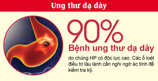 Vi Khuẩn Hp Có Gây Ung Thư Dạ Dày Không?