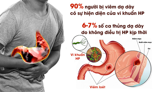Vi Khuẩn Hp Dạ Dày Và Những Điều Cần Biết