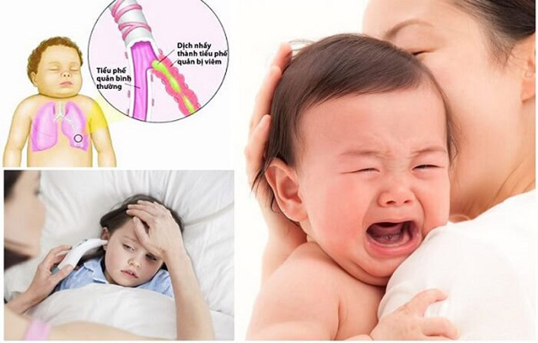 Nguyên Nhân Gây Viêm Phế Quản Ở Trẻ Em