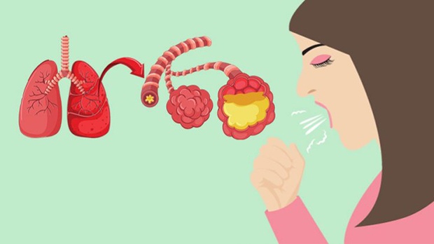 Nhận Biết Viêm Phổi Sớm Để Kịp Thời Điều Trị(CAM)