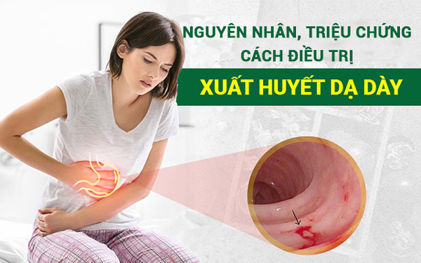 Những Thông Tin Đầy Đủ Về Bệnh Xuất Huyết Dạ Dày