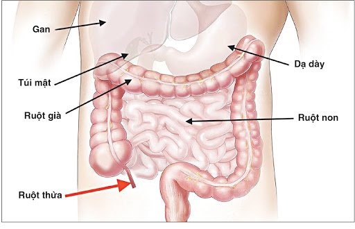 Viêm ruột thừa cấp: triệu chứng nhận biết nguyên nhân, chẩn đoán phân biệt và cách điều trị.